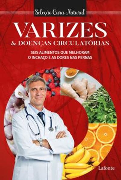 Picture of VARIZES E DOENÇAS CIRCULATORIAS